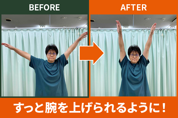 before after