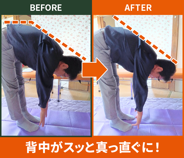 before after
